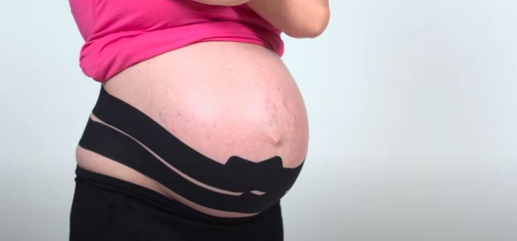What Is Pregnancy Spider Tape? Maternal Support Unveiled !